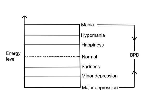 hypomania chart